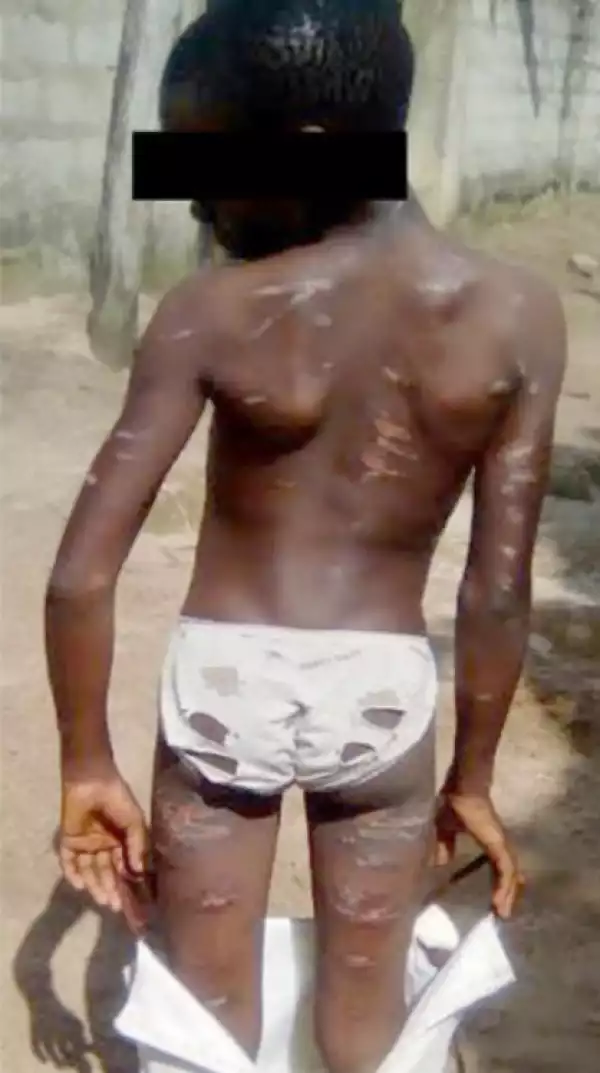 Photos: Nigerian Man Beats Housemaid, Rubs Salt And Pepper Into Her Wounds